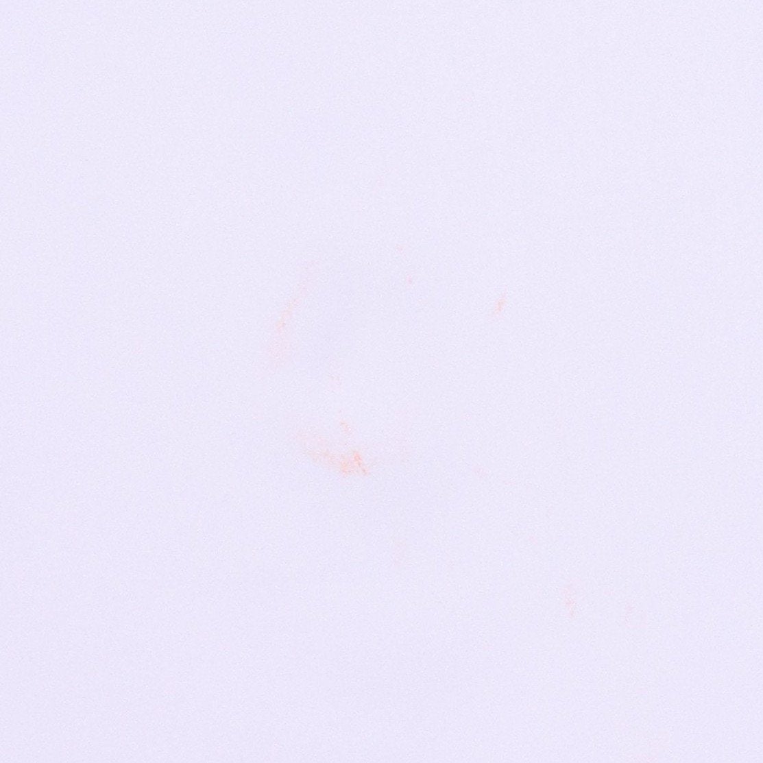 CD8-CTMN | MEN